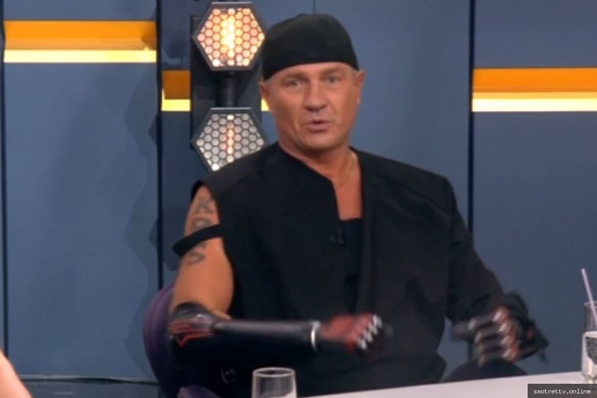 Роман Костомаров о протезах в шоу «Секрет на миллион»: «Это больше для эстетики»